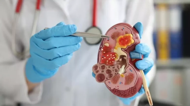 world-kidney-day-2025-protect-your-kidneys-in-this-way