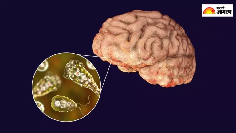 primary-amebic-meningoencephalitis-pam-outbreak-in-kerala-brain-eating-amoeba-concerns-rise