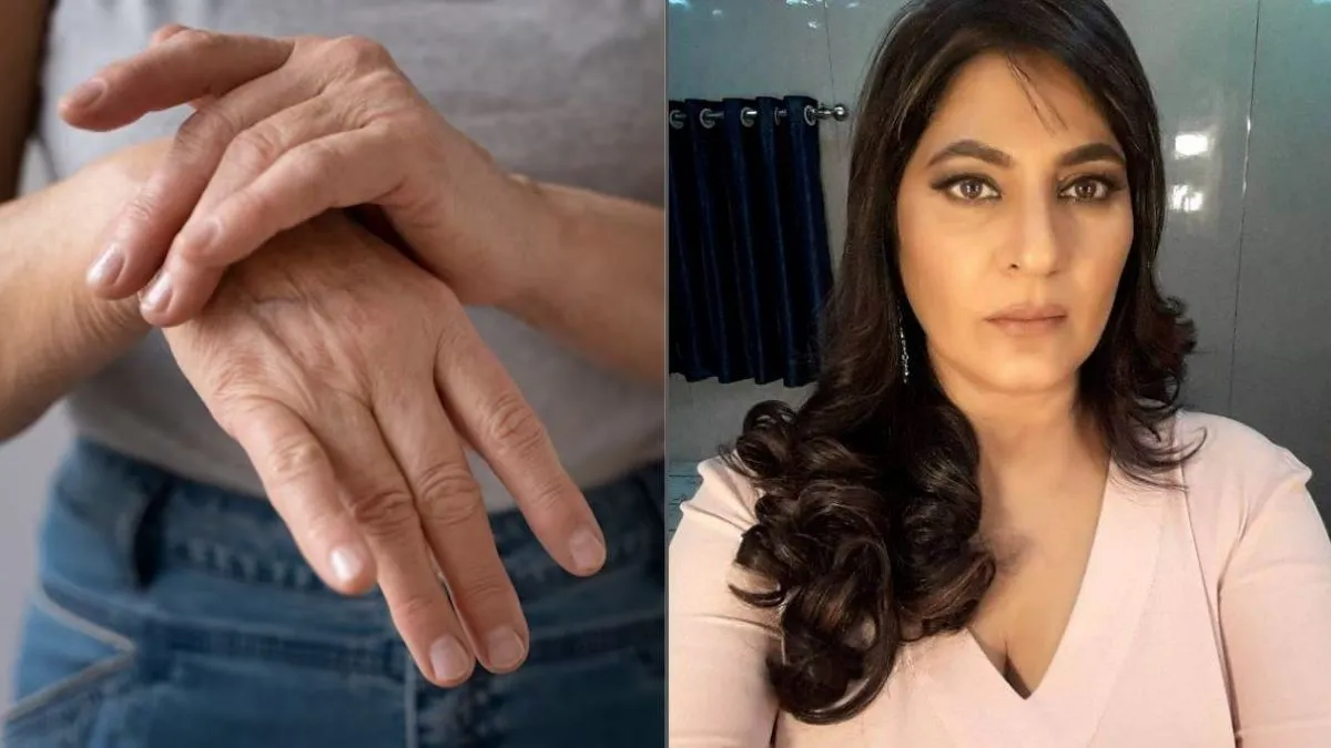 दुखापत बरी झाल्यानंतरही वेदना कमी होत नाहीत का? अर्चना पूरण सिंगला झाला असावा CRPS आजार  