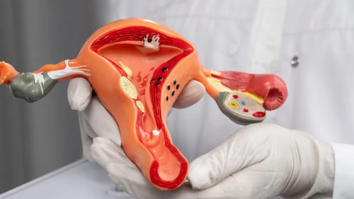 सर्वाइकल कॅन्सरने दर 7 मिनिटांनी एका महिलेचा मृत्यू होतो; वेळीच ओळख कर्करोगाचे लक्षण 