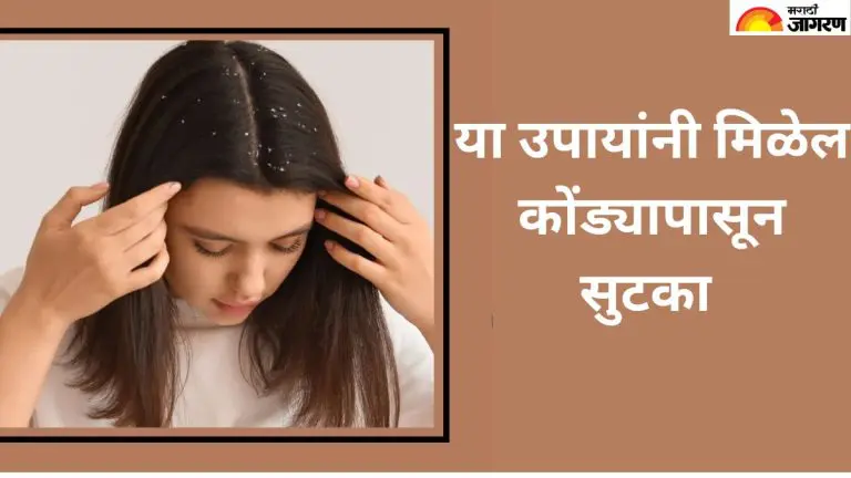 these-kitchen-remedies-will-provide-quick-relief-from-dandruff